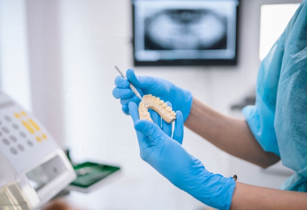 Emax Crowns in Spain