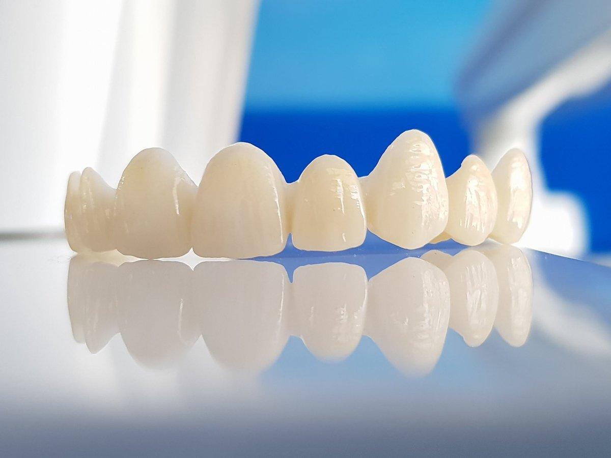 Zirconium Crowns in Spain