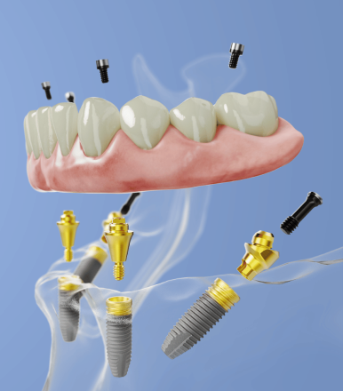 dental treatments in spain