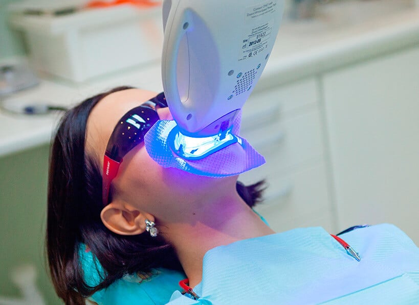 Professional teeth whitening in Spain