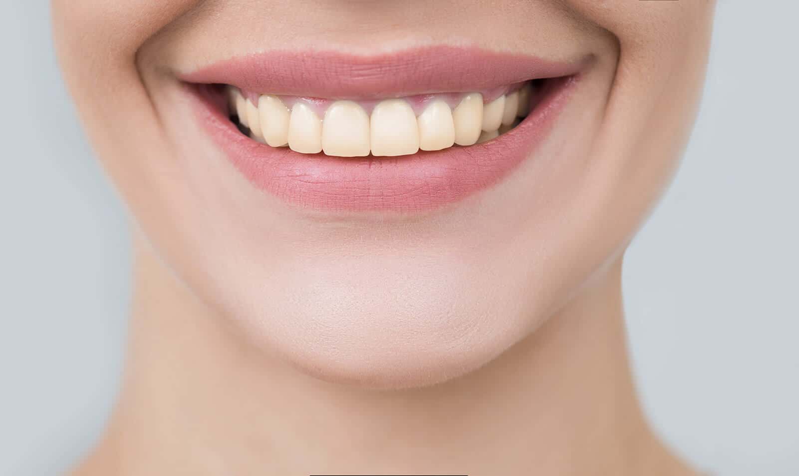 professional dental whitening spain